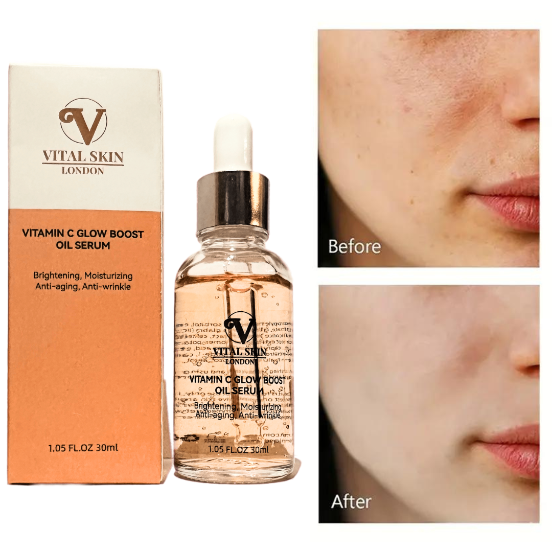 Vitamin C serum for Skin Glow 30ml-3