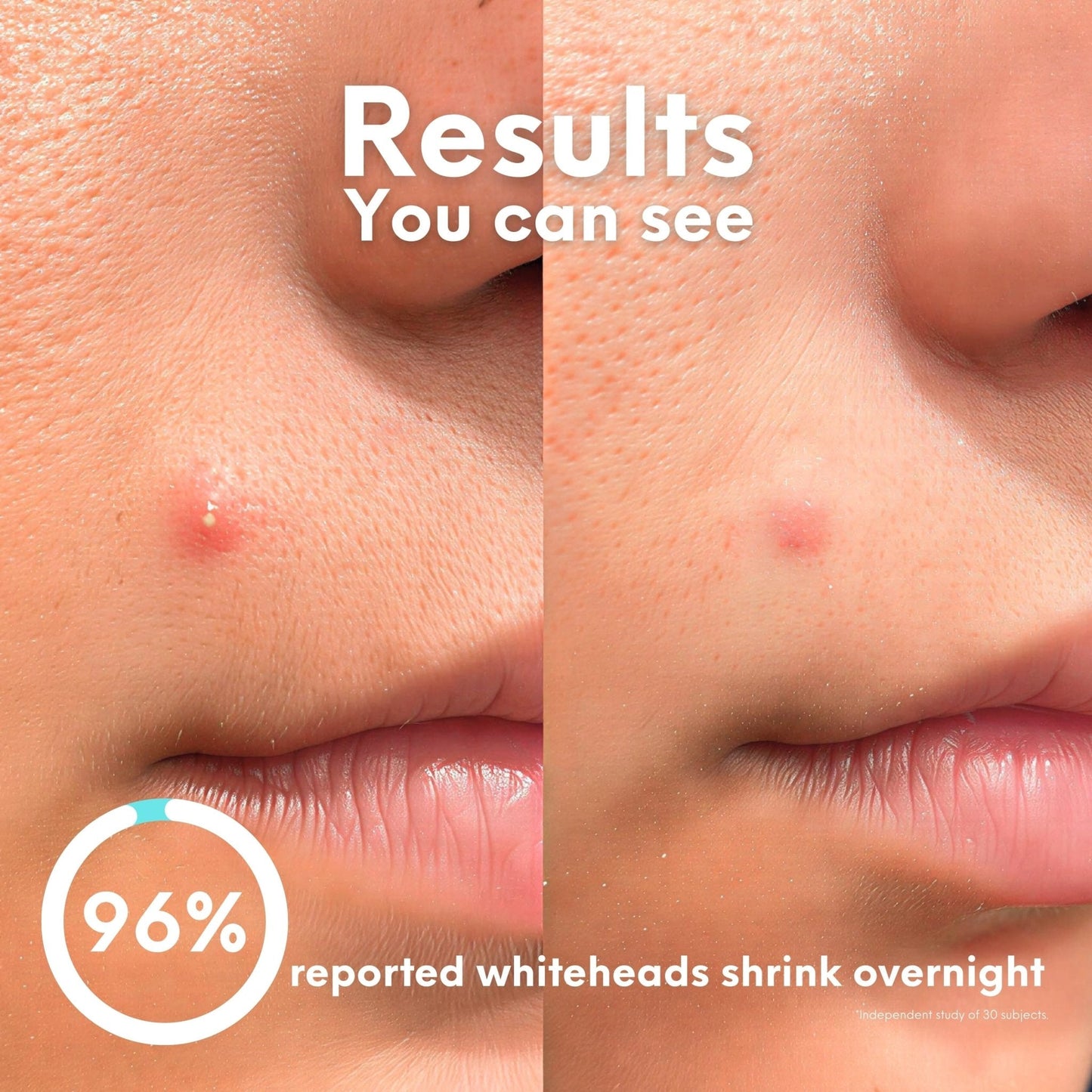 Breakout Classic Duo-2