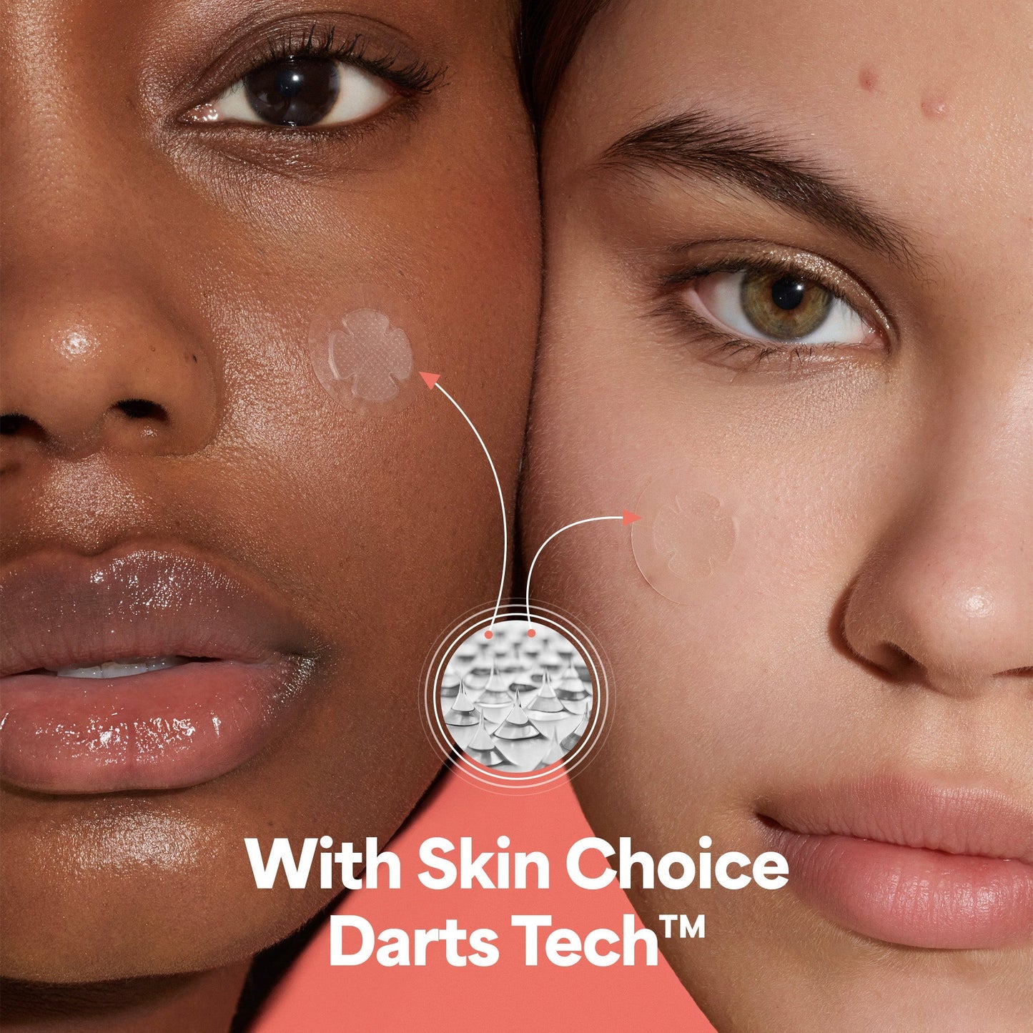 Classic Blemish Trio Plus+-2