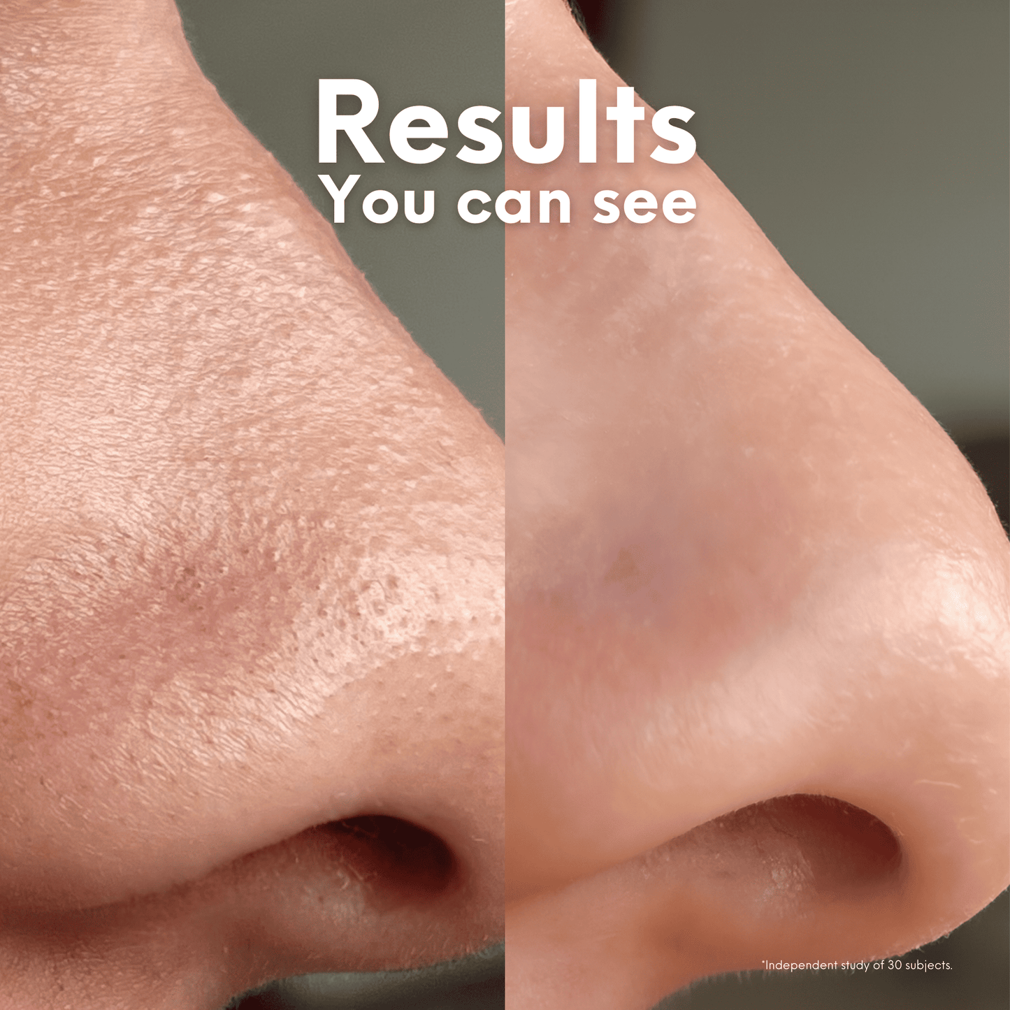 Breakout Patch Classic Nose-4