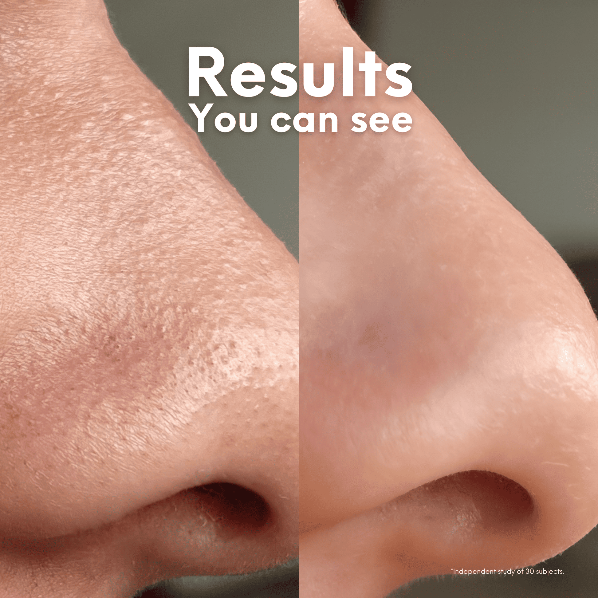 Breakout Patch Classic Nose-4